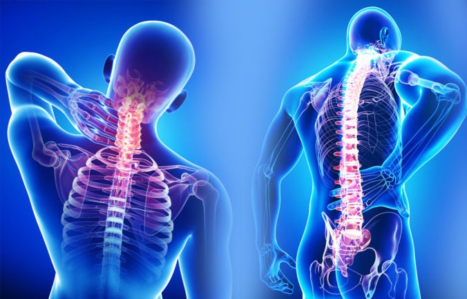 Fibromiyalji Nedir? Belirtileri ve Tedavi Yöntemleri
